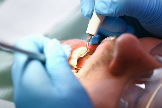 Best Broken or Cracked Tooth Emergency Dentist in Delisle, MS